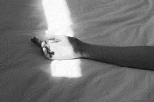 Εμβρυομεταφορά και βελονισμός την ίδια ημέρα – same day 